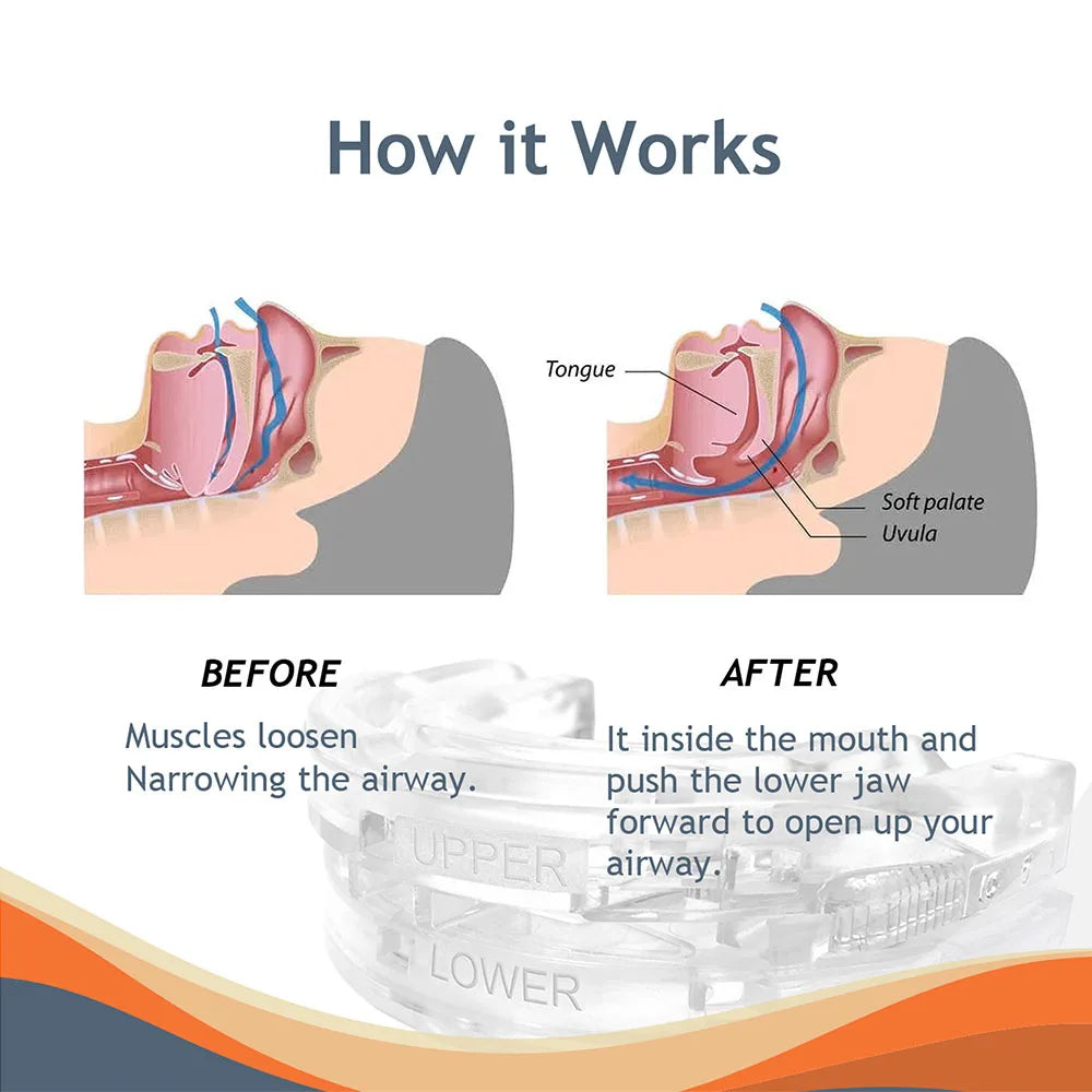 https://ae01.alicdn.com/kf/S441ca982d9644db0ae0f8c65f90c2ebdO/Anti-Snoring-Bruxism-Mouth-Guard-Improve-Sleeping-Teeth-Bruxism-Sleeping-Anti-Snoring-And-Apnea-Snoring-Device.jpg